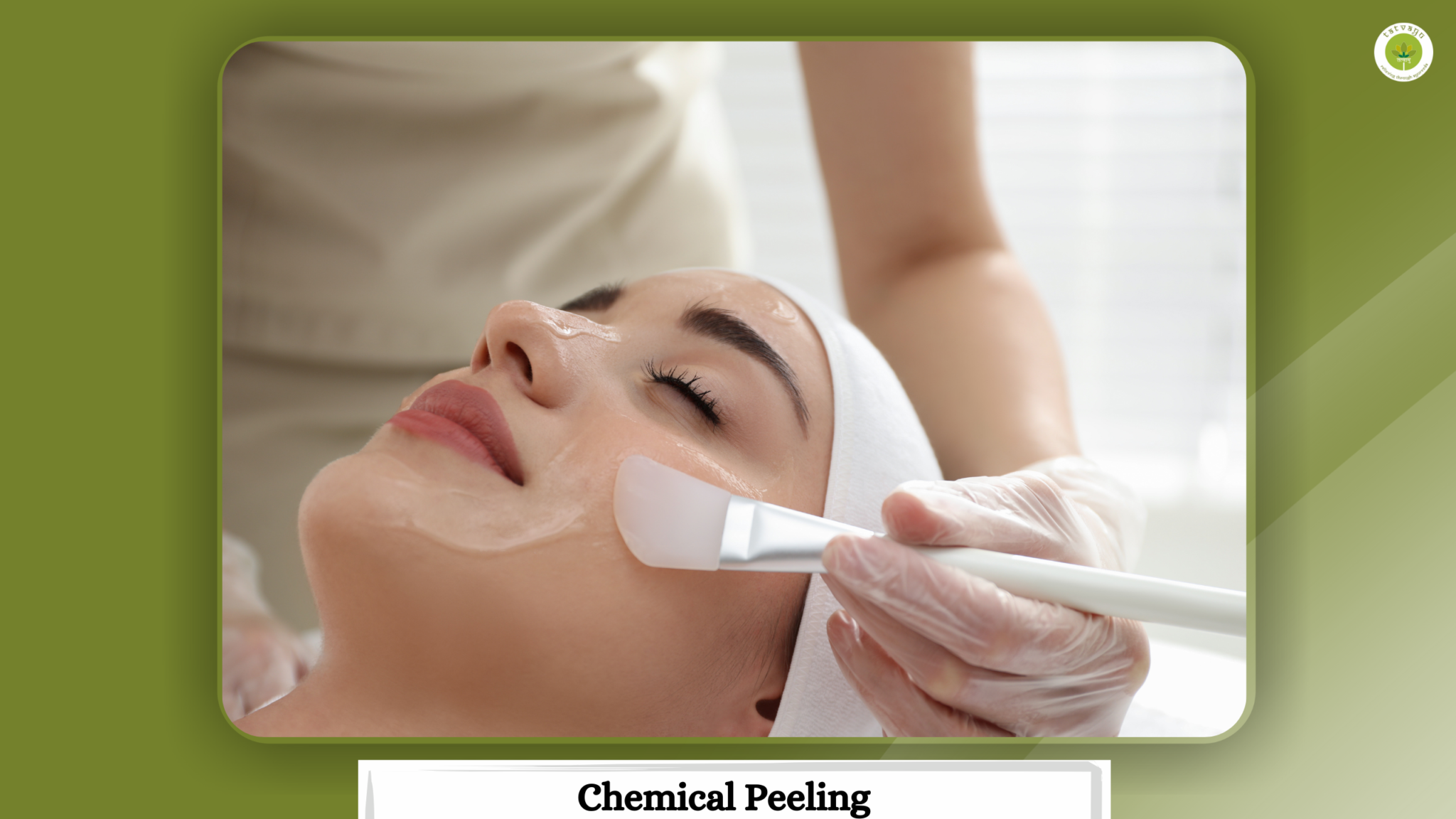 Chemical Peeling best ayurvedic hospital in Vadodara