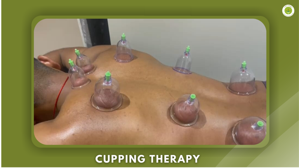 Cupping Therapy ayurvedic treatments in Vadodara best ayurvedic hospital in Vadodara