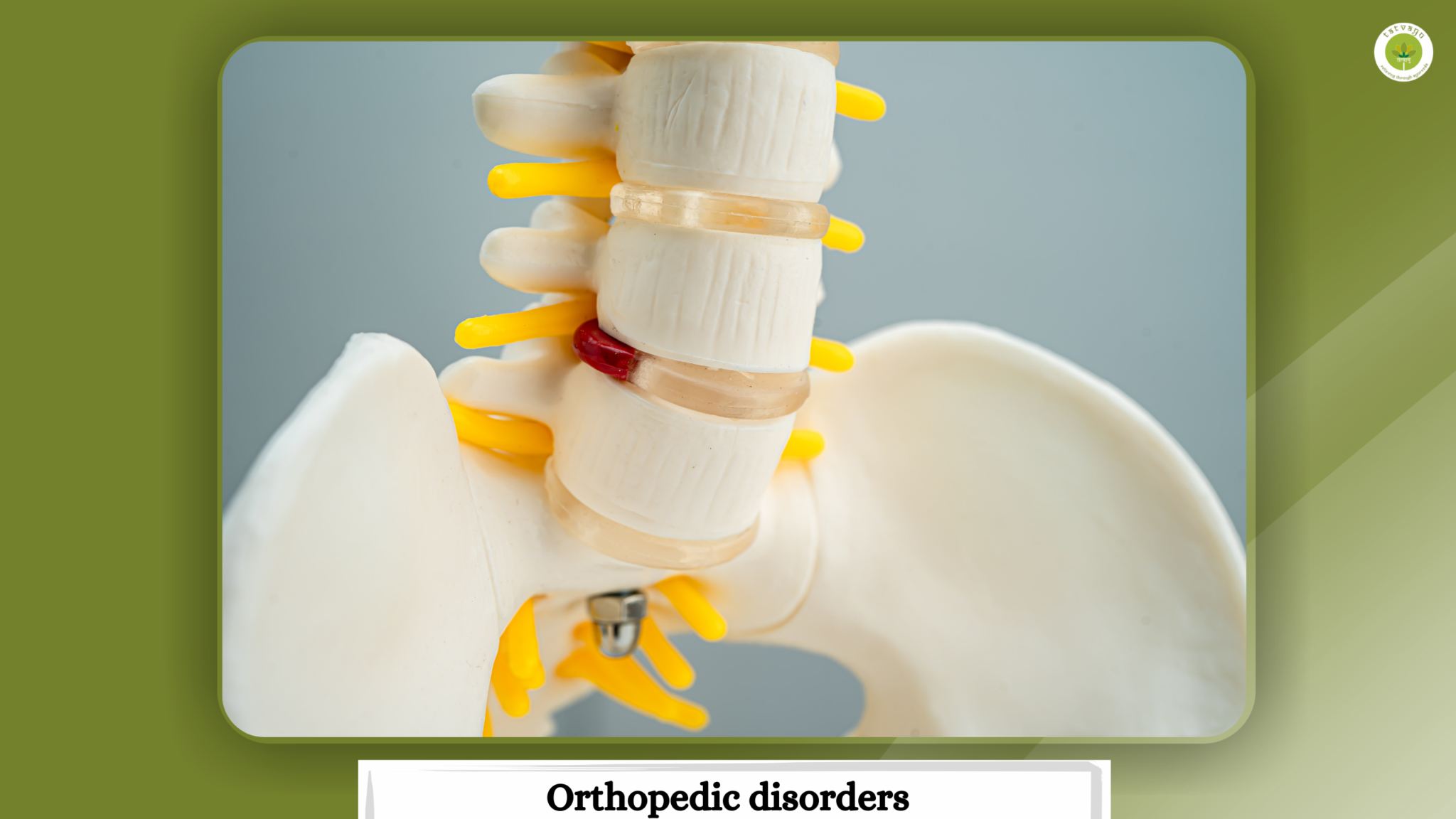 ayurvedic treatment in vadodara