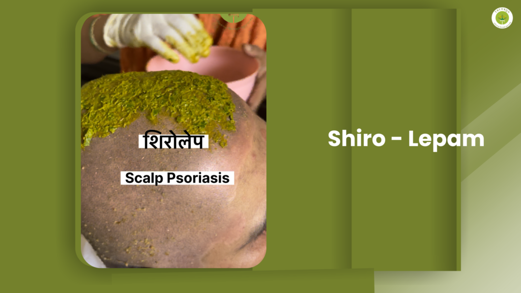 Shiro - Lepam ayurvedic treatment in vadodara